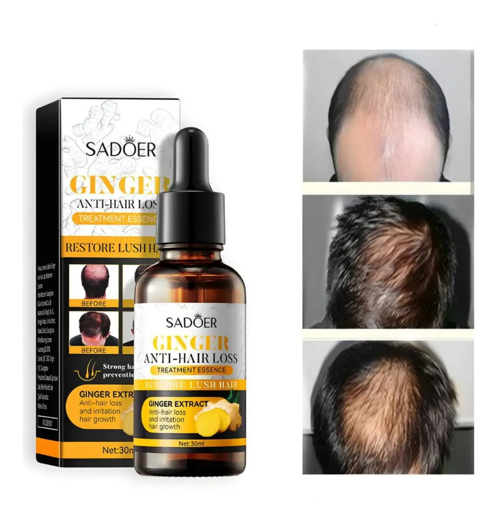 Tratamiento Anticaída SADOER con Extracto de Jengibre – Serum Capilar 30ml